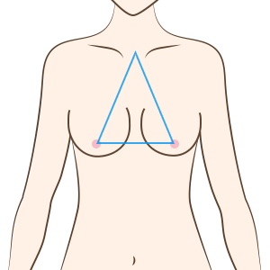 乳房下垂
