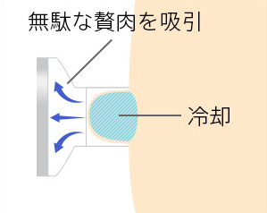 クールスカルプティング®の仕組み