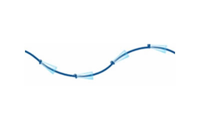 シルエットリフトの特徴
