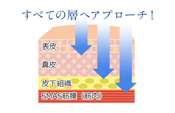 ウルトラセル3Dリフトアップは皮膚のすべての層にアプローチ