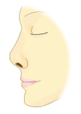 鼻中隔延長術イラスト